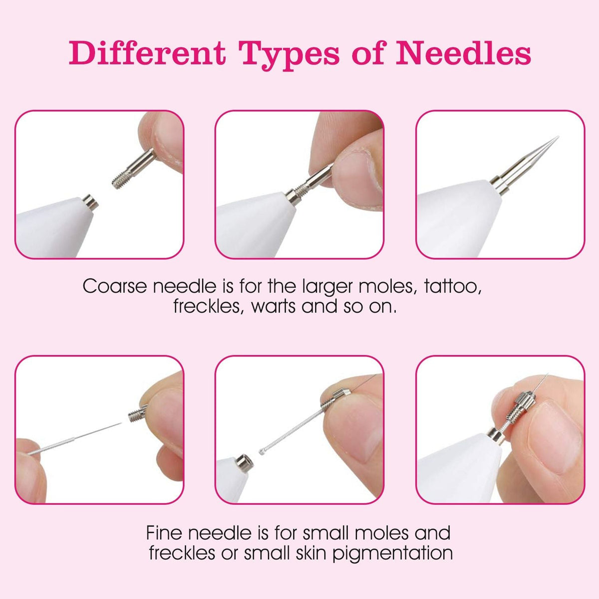 Skin Tag Removal Kit - Portable Multi-Level Beauty Tool with Adjustable LCD & USB Charging, 6 Replacement Needle Options for Home Use - MC Online