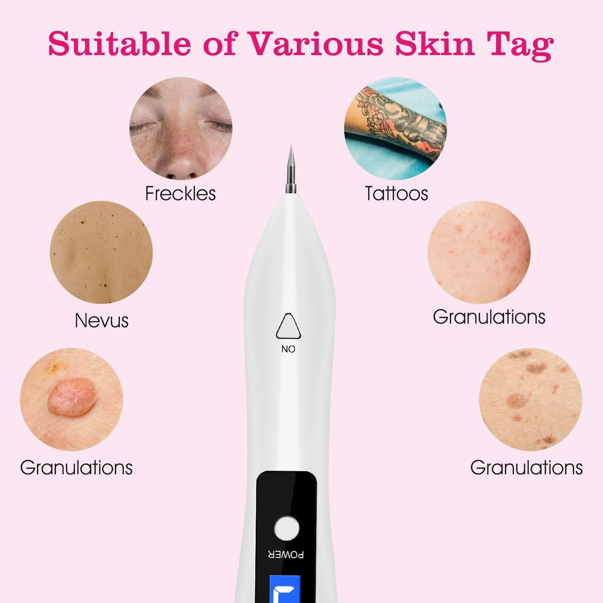 Skin Tag Removal Kit - Portable Multi-Level Beauty Tool with Adjustable LCD & USB Charging, 6 Replacement Needle Options for Home Use - MC Online